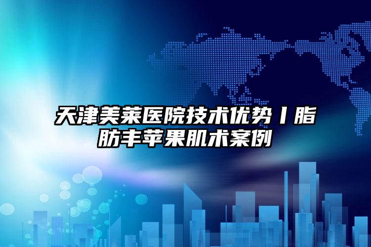 天津美莱医院技术优势丨脂肪丰苹果肌术案例