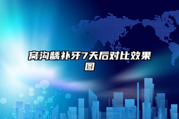 窝沟龋补牙7天后对比效果图