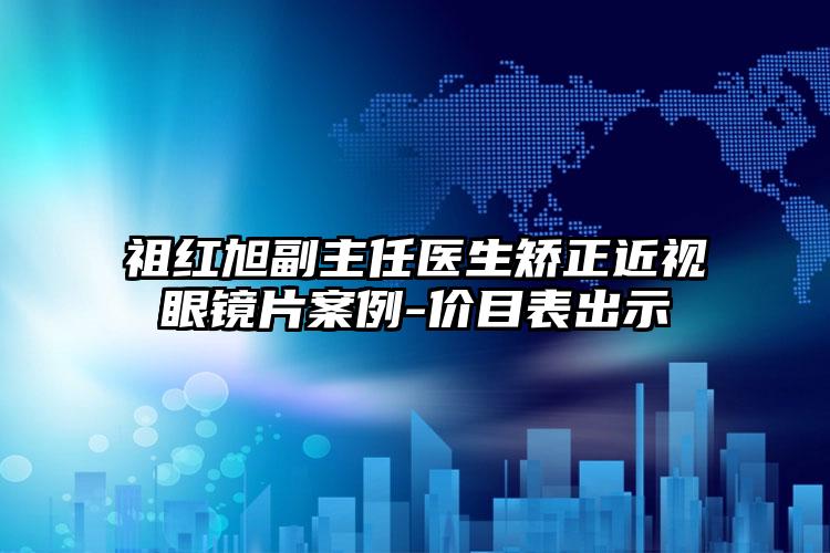 祖红旭副主任医生矫正近视眼镜片案例-价目表出示