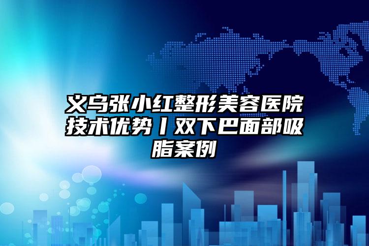 义乌张小红整形美容医院技术优势丨双下巴面部吸脂案例