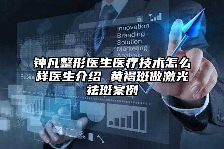 钟凡整形医生医疗技术怎么样医生介绍 黄褐斑做激光祛斑案例