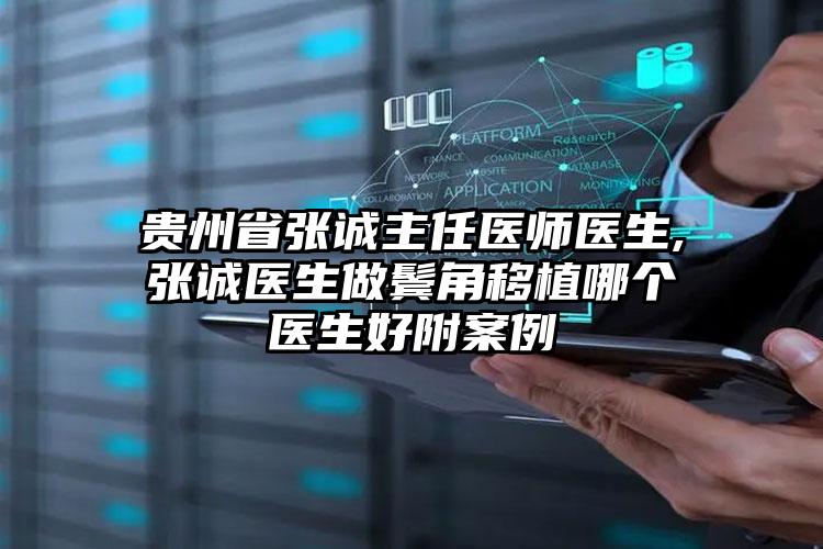 贵州省张诚主任医师医生,张诚医生做鬓角移植哪个医生好附案例