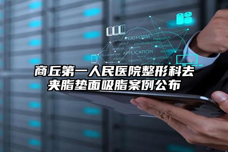商丘第一人民医院整形科去夹脂垫面吸脂案例公布
